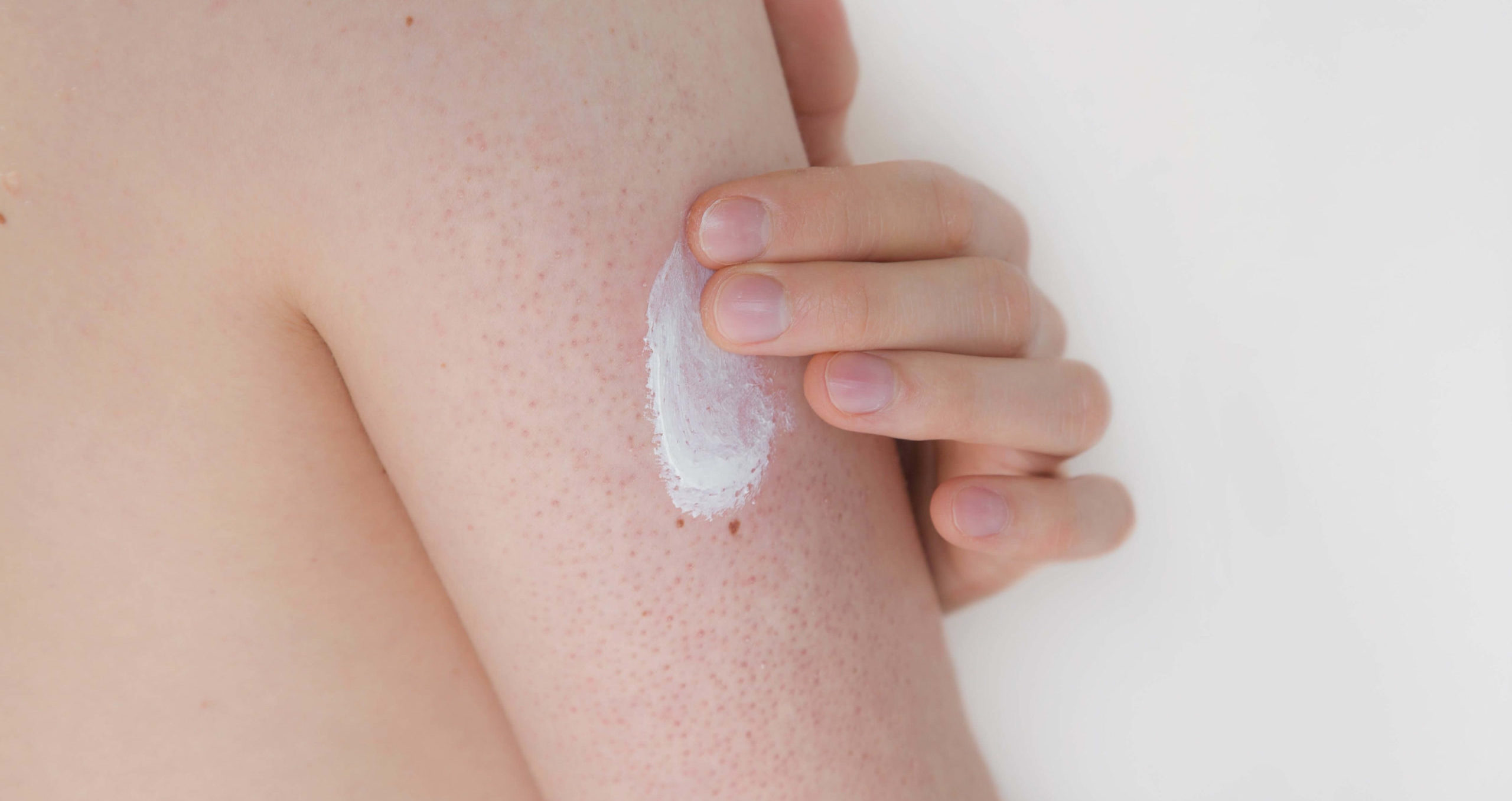 glutathione tablets before and after before and after glutathione tablets Glutathione Tablets For Skin Whitening:  How To Use, Benefits & Side Effects